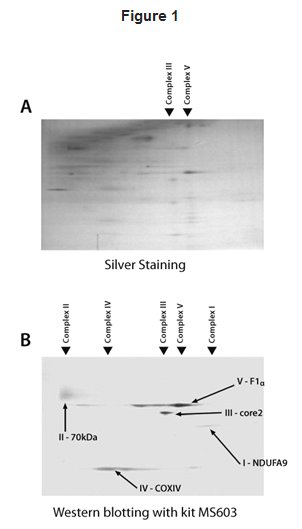 Western blot - Total OXPHOS Blue Native WB Antibody Cocktail (AB110412), expandable thumbnail
