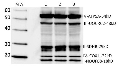 Western blot - Total OXPHOS Human WB Antibody Cocktail (AB110411), expandable thumbnail