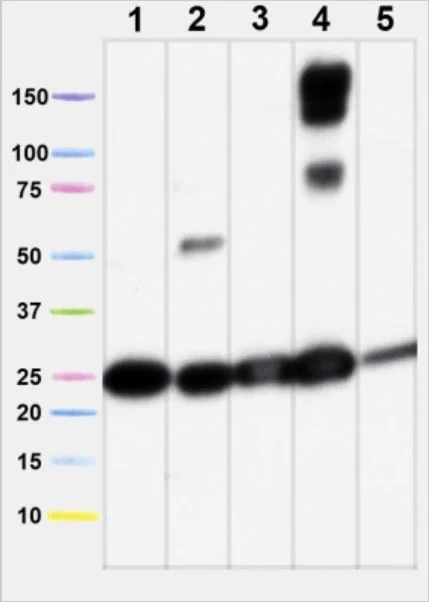 Western blot - Total OXPHOS Rodent WB Antibody Cocktail (AB110413)