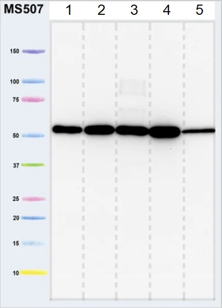 Western blot - Total OXPHOS Rodent WB Antibody Cocktail (AB110413)