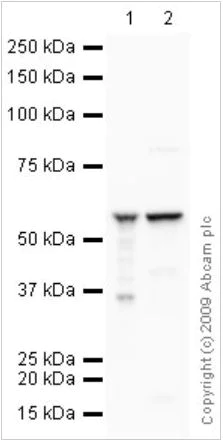 Western blot - Total OXPHOS Rodent WB Antibody Cocktail (AB110413)