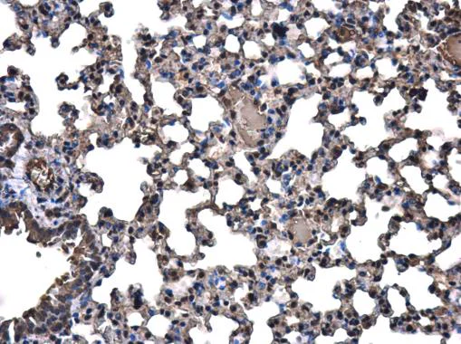 Immunohistochemistry (Formalin/PFA-fixed paraffin-embedded sections) - Anti-TOX antibody (AB155768)