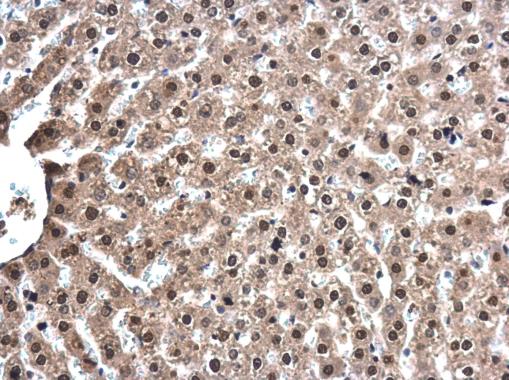 Anti-TOX antibody (ab155768) | Abcam
