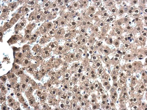 Immunohistochemistry (Formalin/PFA-fixed paraffin-embedded sections) - Anti-TOX antibody (AB155768)