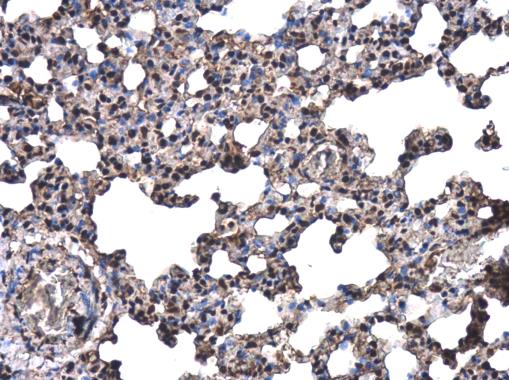 Immunohistochemistry (Formalin/PFA-fixed paraffin-embedded sections) - Anti-TOX antibody (AB155768)