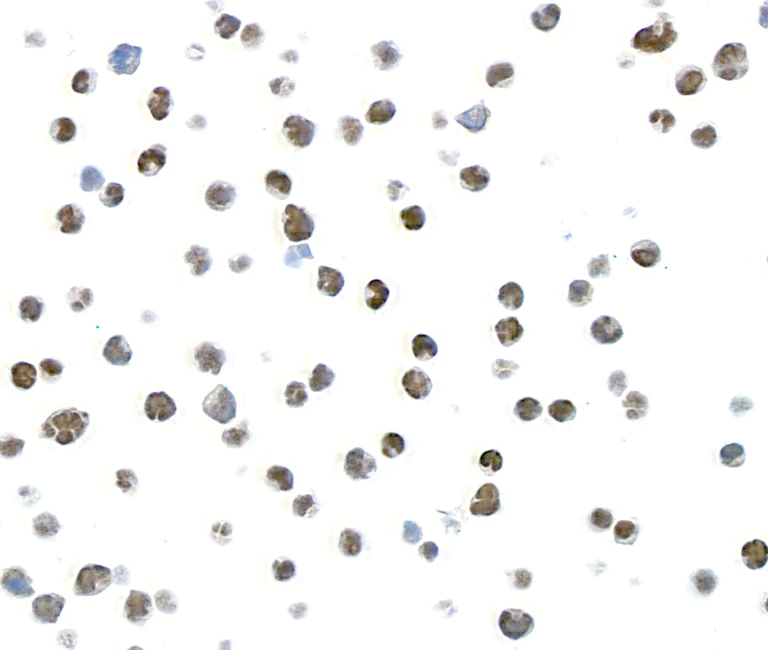 Immunohistochemistry (Formalin/PFA-fixed paraffin-embedded sections) - Anti-TOX antibody [BLR212K] - BSA free (AB314043)
