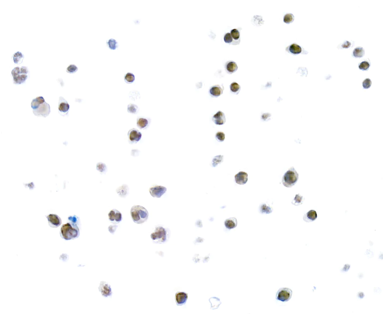 Immunohistochemistry (Formalin/PFA-fixed paraffin-embedded sections) - Anti-TOX antibody [BLR212K] - BSA free (AB314043)