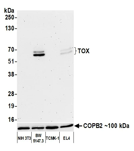 Western blot - Anti-TOX antibody [BLR212K] - BSA free (AB314043)