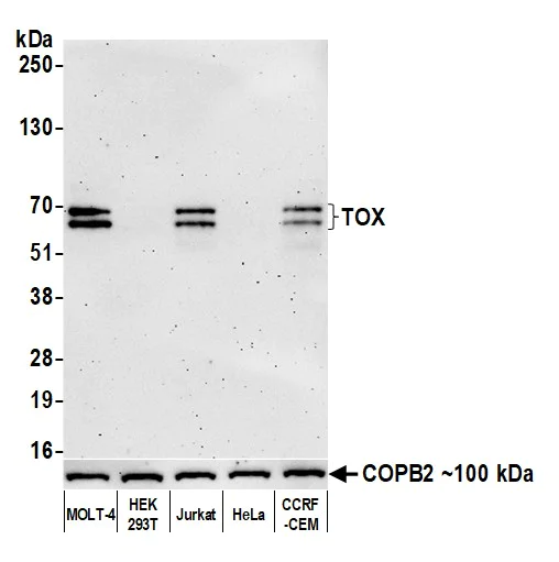 Western blot - Anti-TOX antibody [BLR212K] - BSA free (AB314043)