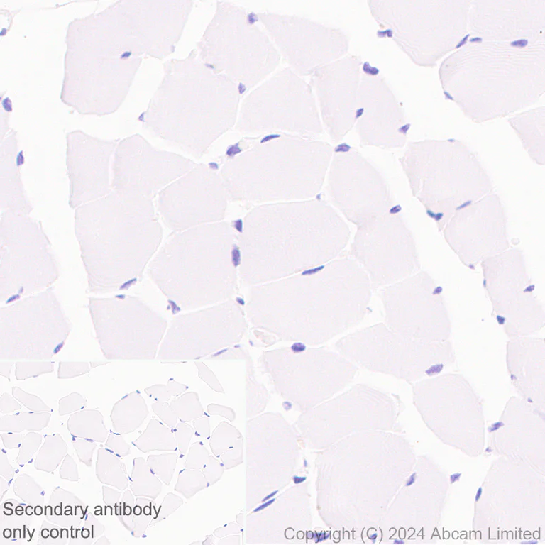 Immunohistochemistry (Formalin/PFA-fixed paraffin-embedded sections) - Anti-TOX antibody [EPR28108-10] (AB322259)