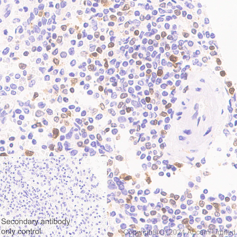 Immunohistochemistry (Formalin/PFA-fixed paraffin-embedded sections) - Anti-TOX antibody [EPR28108-10] (AB322259)