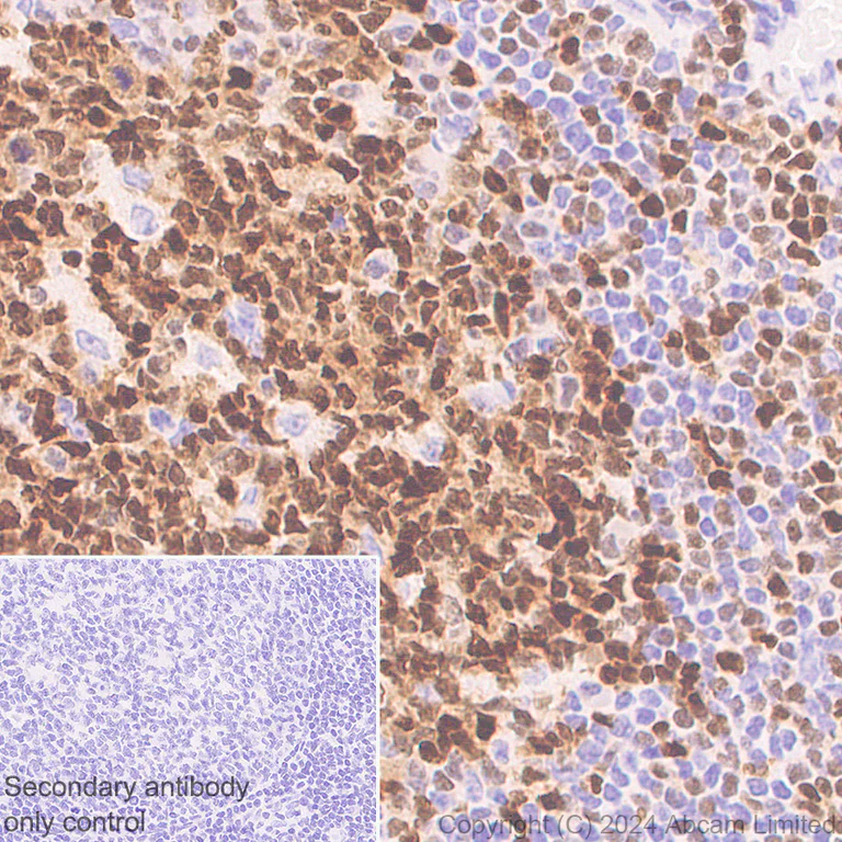 Immunohistochemistry (Formalin/PFA-fixed paraffin-embedded sections) - Anti-TOX antibody [EPR28108-10] (AB322259)