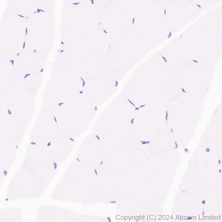 Immunohistochemistry (Formalin/PFA-fixed paraffin-embedded sections) - Anti-TOX antibody [EPR28108-10] (AB322259)