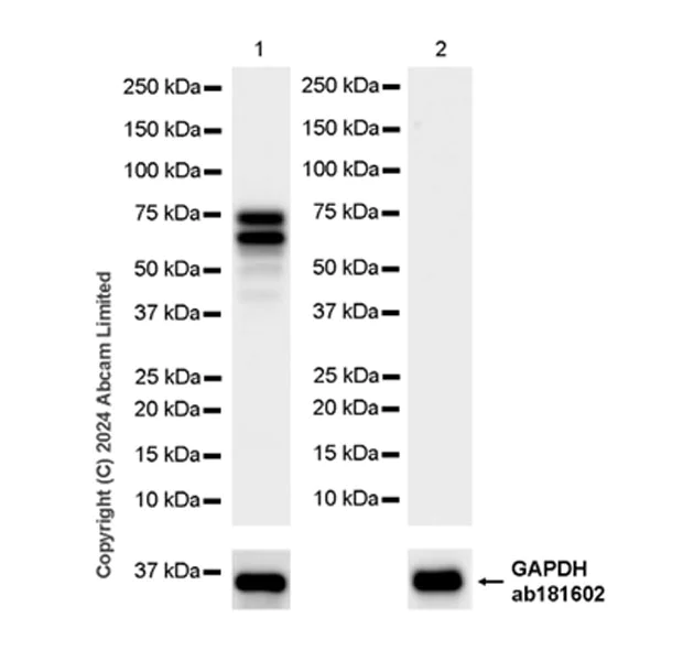 Western blot - Anti-TOX antibody [EPR28108-10] (AB322259)