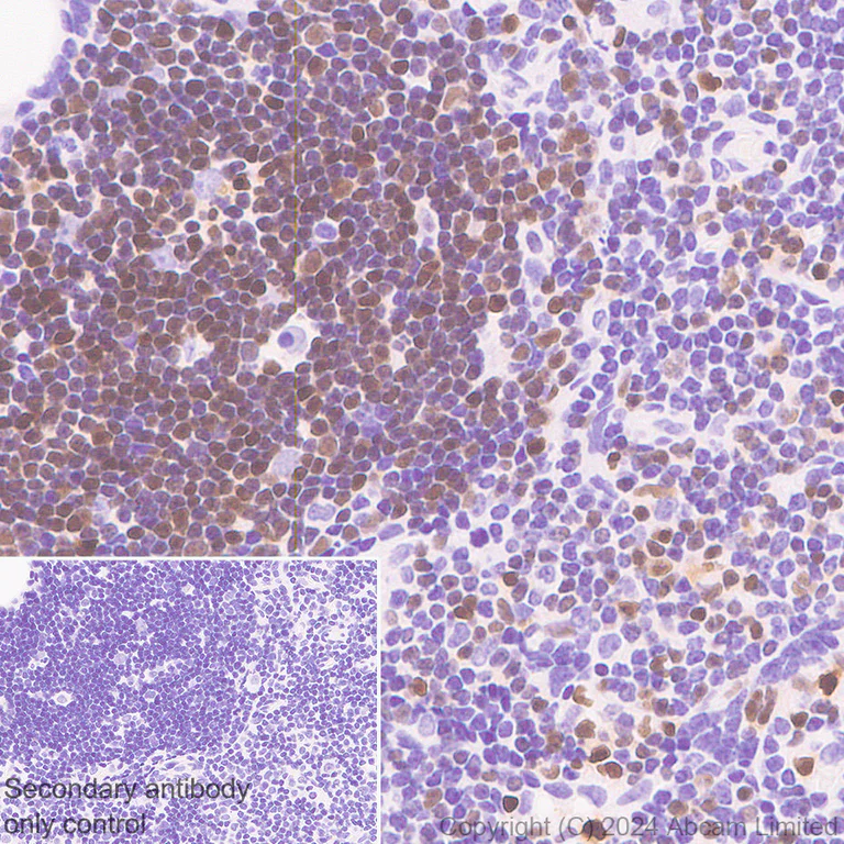 Immunohistochemistry (Formalin/PFA-fixed paraffin-embedded sections) - Anti-TOX antibody [EPR28108-10] - BSA and Azide free (AB324784)