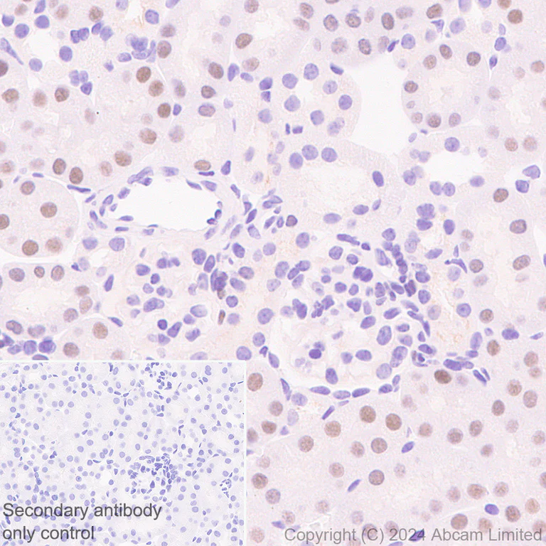 Immunohistochemistry (Formalin/PFA-fixed paraffin-embedded sections) - Anti-TOX antibody [EPR28108-10] - BSA and Azide free (AB324784)