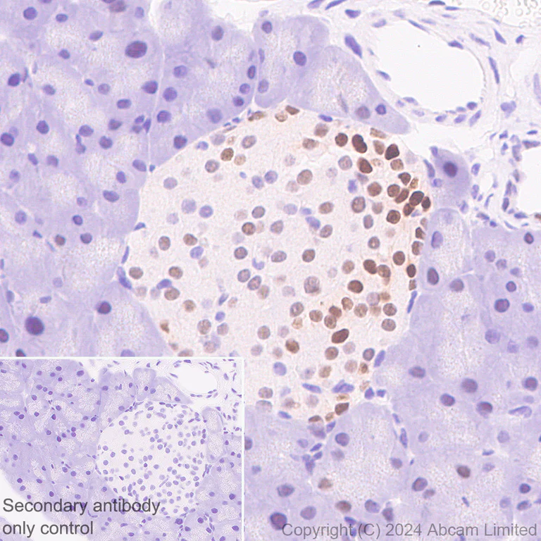 Immunohistochemistry (Formalin/PFA-fixed paraffin-embedded sections) - Anti-TOX antibody [EPR28108-10] - BSA and Azide free (AB324784)