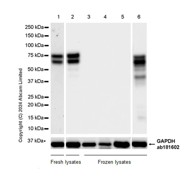 Western blot - Anti-TOX antibody [EPR28108-10] - BSA and Azide free (AB324784)