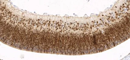 Immunohistochemistry (Formalin/PFA-fixed paraffin-embedded sections) - Anti-TOX antibody [NAN448B] (AB237009)