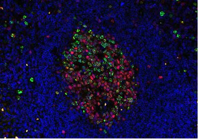 Immunohistochemistry (Formalin/PFA-fixed paraffin-embedded sections) - Anti-TOX antibody [NAN448B] (AB237009)