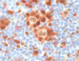 Immunohistochemistry (Formalin/PFA-fixed paraffin-embedded sections) - Anti-TOX antibody [NAN448B] (AB237009)