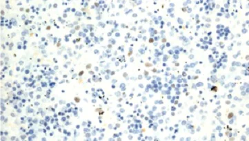 Immunohistochemistry (Formalin/PFA-fixed paraffin-embedded sections) - Anti-TOX antibody [NAN448B] (AB237009)