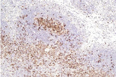 Immunohistochemistry (Formalin/PFA-fixed paraffin-embedded sections) - Anti-TOX antibody [NAN448B] (AB237009)