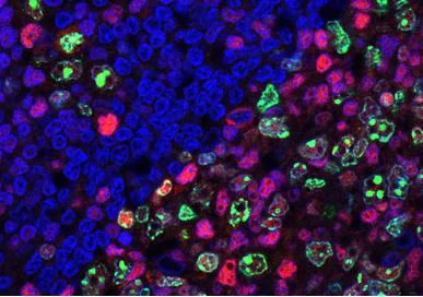 Immunohistochemistry (Formalin/PFA-fixed paraffin-embedded sections) - Anti-TOX antibody [NAN448B] (AB237009)