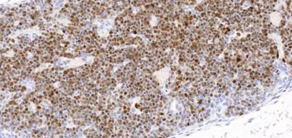 Immunohistochemistry (Formalin/PFA-fixed paraffin-embedded sections) - Anti-TOX antibody [NAN448B] (AB237009)