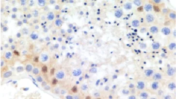 Immunohistochemistry (Formalin/PFA-fixed paraffin-embedded sections) - Anti-TOX antibody [NAN448B] (AB237009)