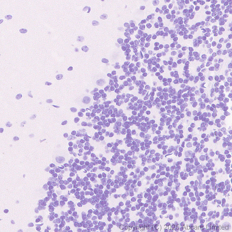 Immunohistochemistry (Formalin/PFA-fixed paraffin-embedded sections) - Anti-TOX antibody [NAN448B] (AB237009)