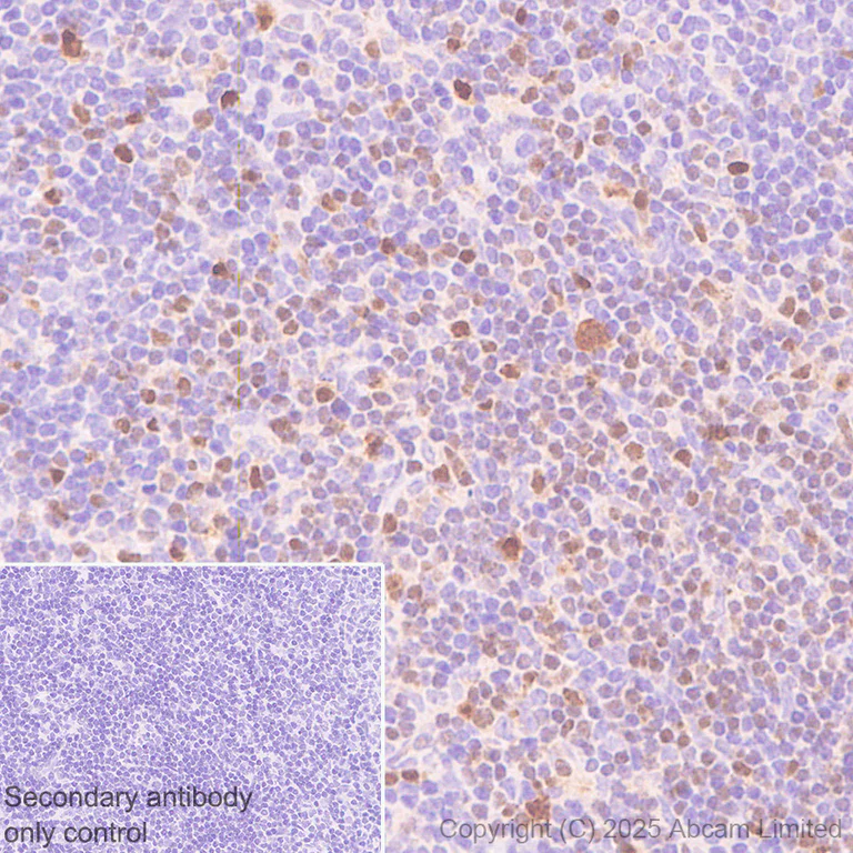Immunohistochemistry (Formalin/PFA-fixed paraffin-embedded sections) - Anti-TOX antibody [NAN448B] (AB237009)