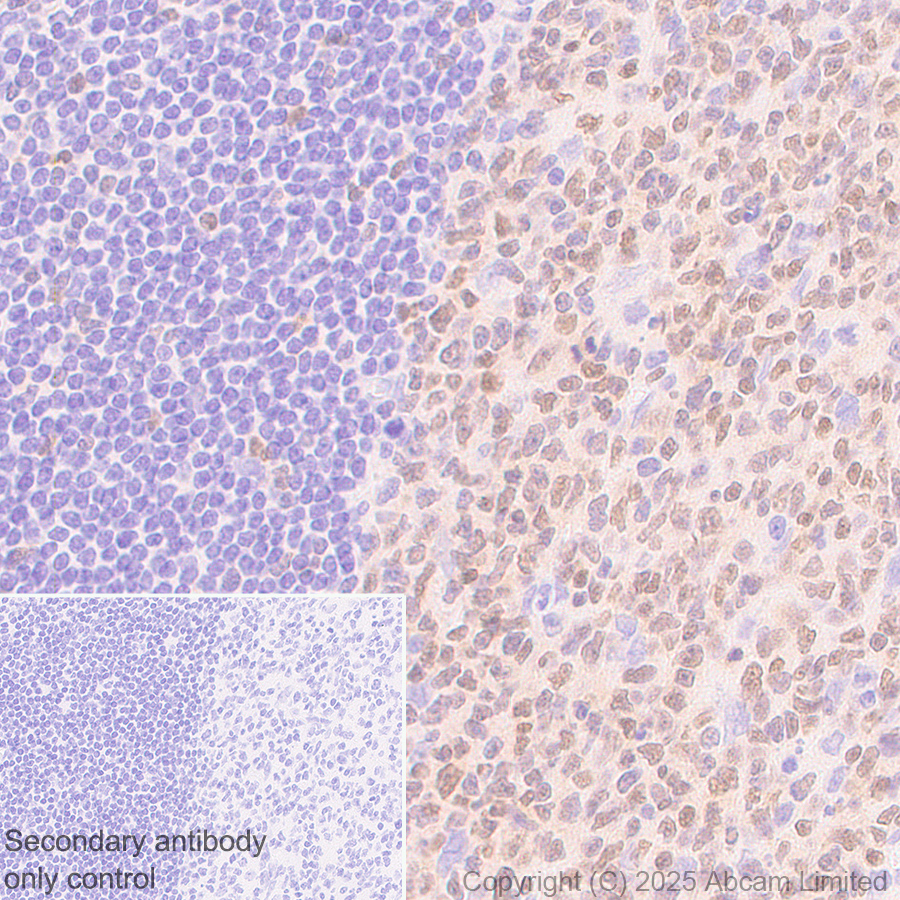 Anti-TOX antibody [NAN448B] (ab237009) | Abcam