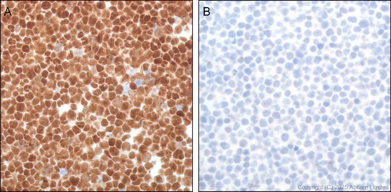 Immunohistochemistry (Formalin/PFA-fixed paraffin-embedded sections) - Anti-TOX antibody [NAN448B] (AB237009)
