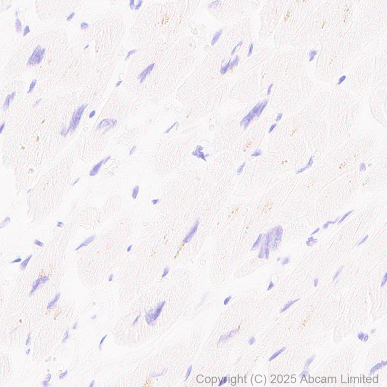 Immunohistochemistry (Formalin/PFA-fixed paraffin-embedded sections) - Anti-TOX antibody [NAN448B] (AB237009)