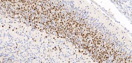 Immunohistochemistry (Formalin/PFA-fixed paraffin-embedded sections) - Anti-TOX antibody [NAN448B] (AB237009)