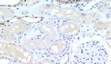 Immunohistochemistry (Formalin/PFA-fixed paraffin-embedded sections) - Anti-TOX antibody [NAN448B] (AB237009)