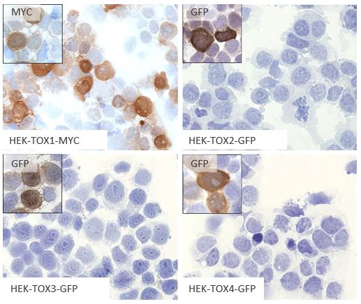 Anti-TOX antibody [NAN448B] (ab237009) | Abcam