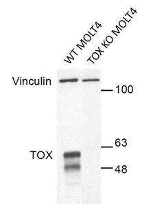 Western blot - Anti-TOX antibody [NAN448B] (AB237009)