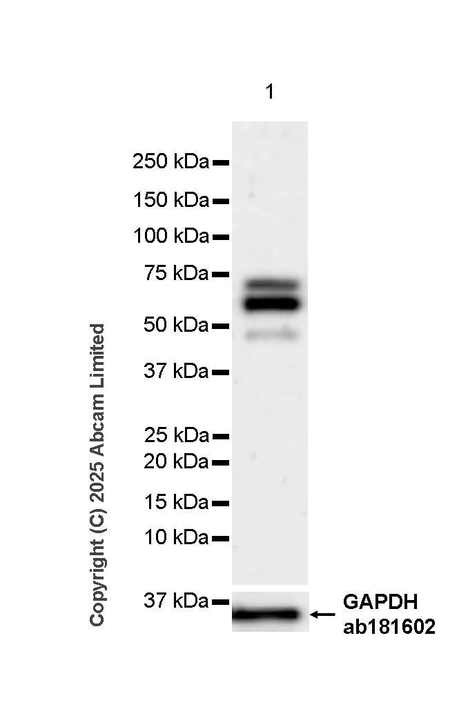 Western blot - Anti-TOX antibody [NAN448B] (AB237009)