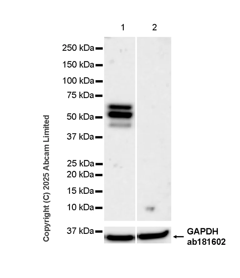 Western blot - Anti-TOX antibody [NAN448B] (AB237009)