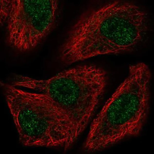 Immunocytochemistry/ Immunofluorescence - Anti-TOX2 antibody (AB220985)