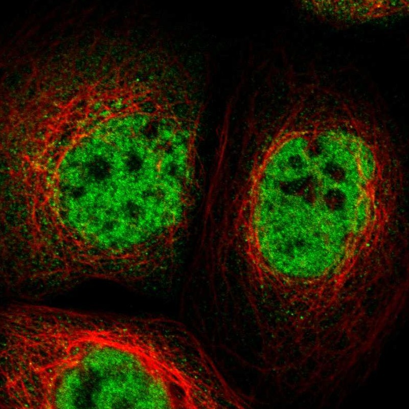 Immunocytochemistry/ Immunofluorescence - Anti-TOX4 antibody (AB272576), expandable thumbnail