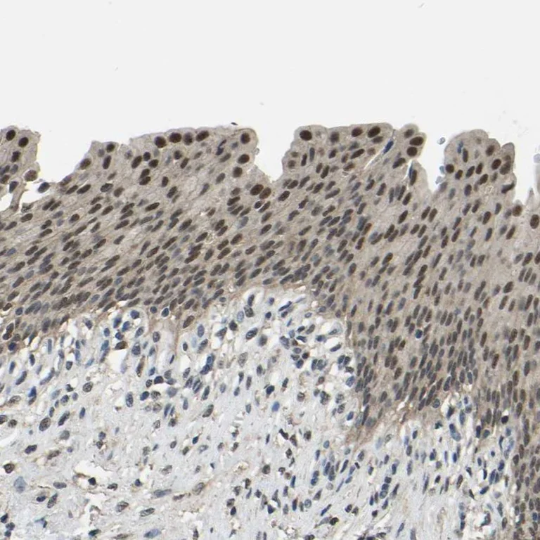 Immunohistochemistry (Formalin/PFA-fixed paraffin-embedded sections) - Anti-TOX4 antibody (AB272576)