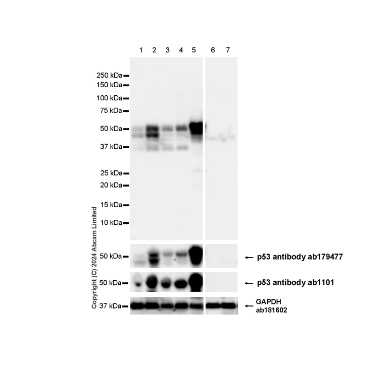 Western blot - Anti-TP53 (phospho S376+S377+S392) antibody [RM1161] (AB322465)
