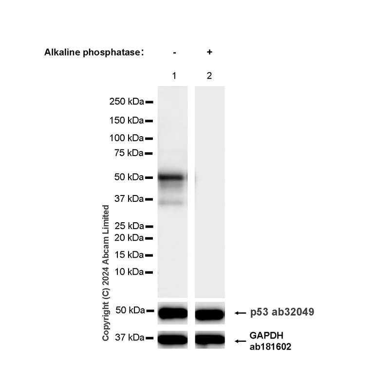 Western blot - Anti-TP53 (phospho S376+S377+S392) antibody [RM1161] (AB322465)