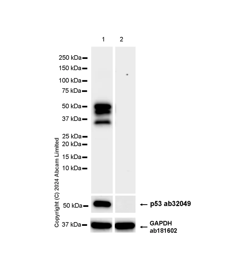 Western blot - Anti-TP53 (phospho S376+S377+S392) antibody [RM1161] (AB322465)