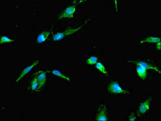 Immunocytochemistry/ Immunofluorescence - Anti-TP53I11 antibody (AB234860)