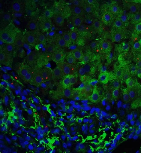 Immunohistochemistry (Formalin/PFA-fixed paraffin-embedded sections) - Anti-TP53INP1 antibody (AB9775)