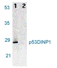 Western blot - Anti-TP53INP1 antibody (AB9775)